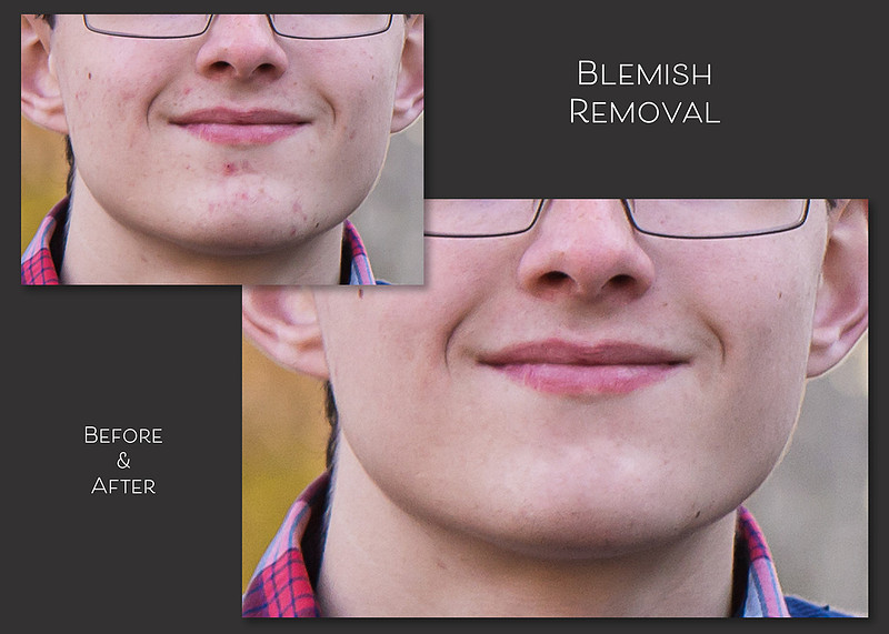 Blemish Removal