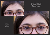 Kieran Stray Hair Removal2