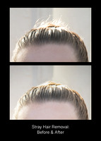 Stray Hair Removal